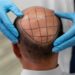 Best Hair Growth Oils for Thinning Hair