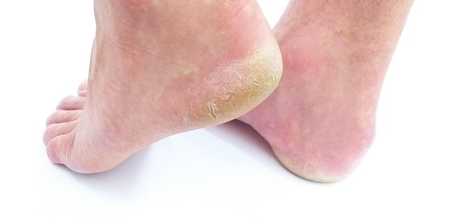 Close-up of white heel shoe with a small scuff mark