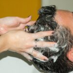 woman with dry scalp applying shampoo