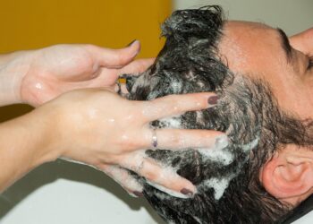 woman with dry scalp applying shampoo