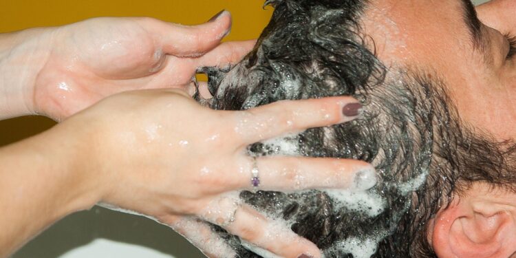 woman with dry scalp applying shampoo