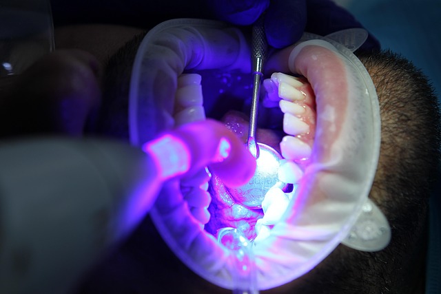 Close-up of teeth whitening strips being applied