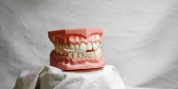 dental veneers close up