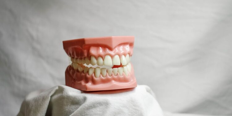 dental veneers close up