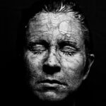 melasma skin patches