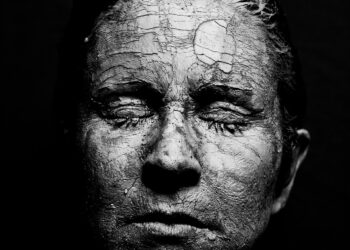 melasma skin patches