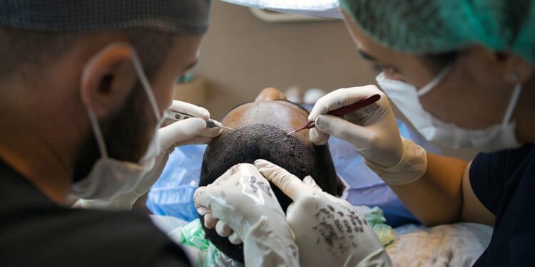 PRP Hair Treatment Cost & Results