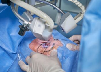 PRP hair treatment procedure