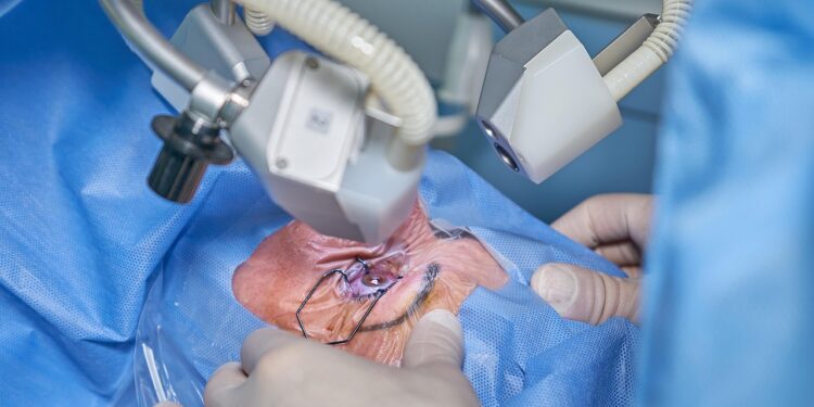 PRP hair treatment procedure