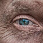 skin aging wrinkles close up