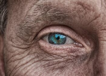 skin aging wrinkles close up