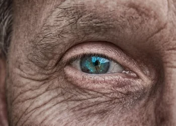 skin aging wrinkles close up