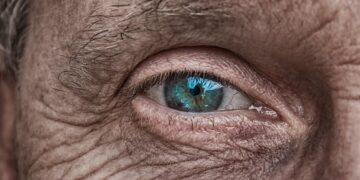 skin aging wrinkles close up