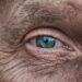 skin aging wrinkles close up