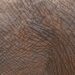 skin texture hyperpigmentation
