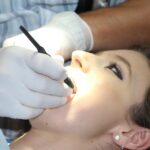 teeth whitening cost comparison