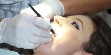 teeth whitening cost comparison
