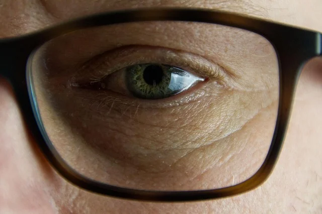 What are the main types of facial wrinkles?