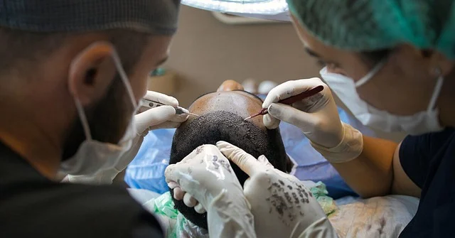 Medical professionals performing a hair transplant surgery on a patient